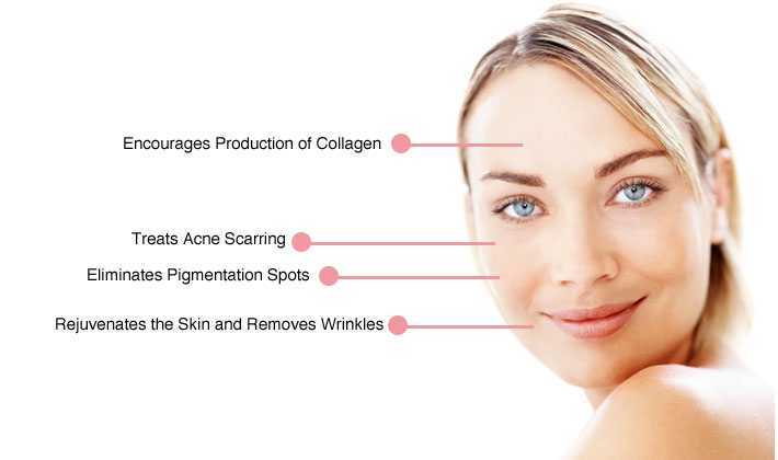 micro-needling-cambridge-rejuvenations